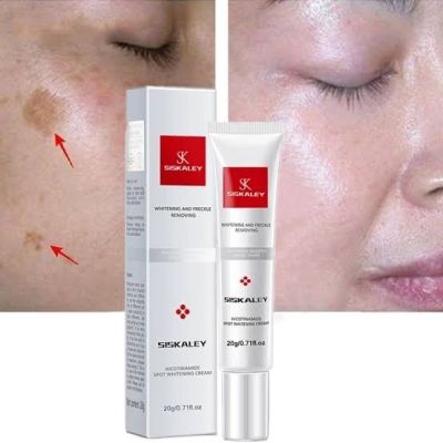 Youbuy Whitening and Freckle Removing Cream
